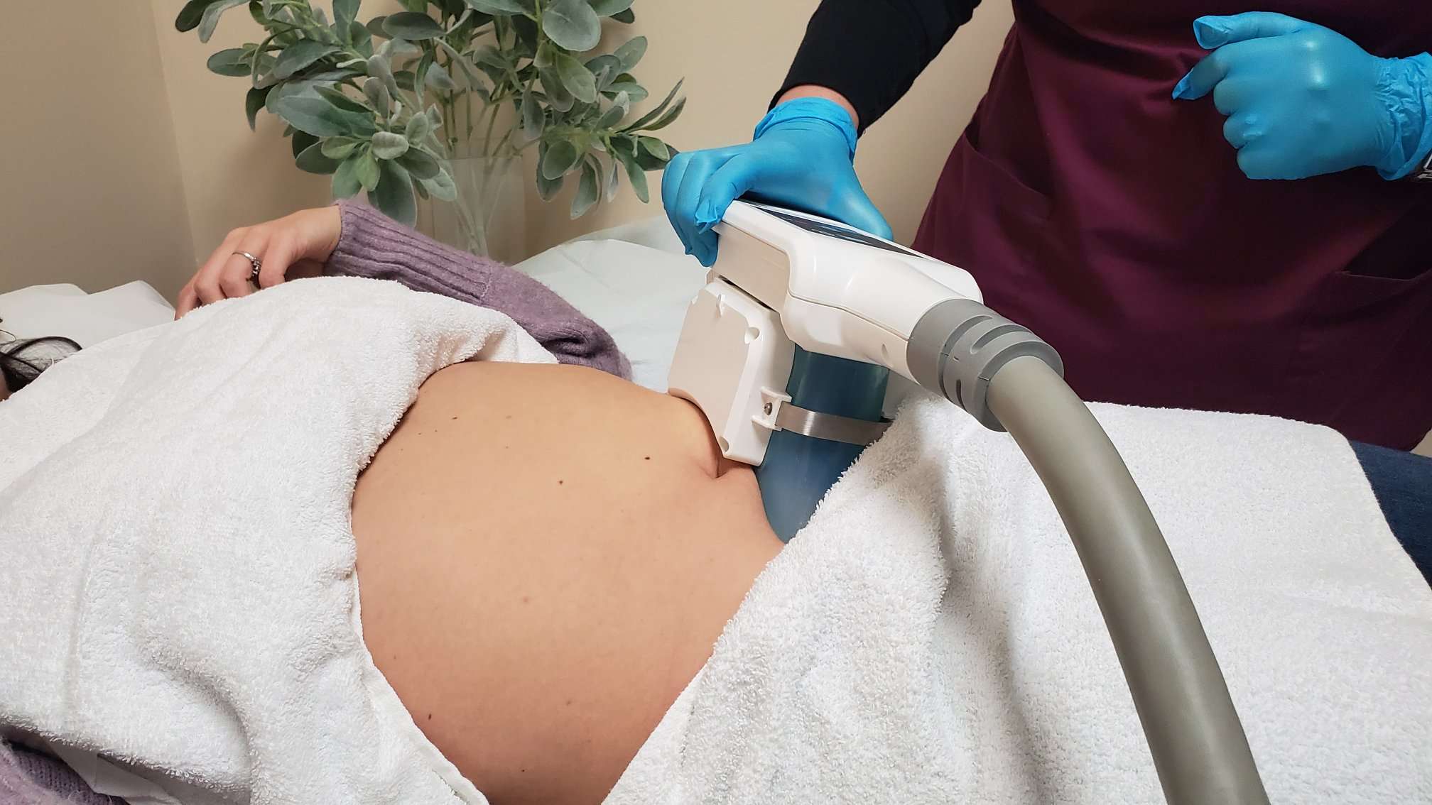 What is the average cost of coolsculpting?
