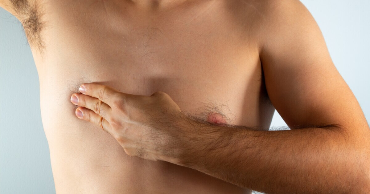 Male Breast Cancer: Recognizing the Symptoms, Causes & Treatment